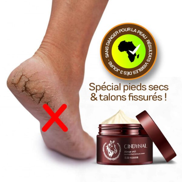 Crème Réparatrice Pieds & Mains à l’Huile de Cheval – CINDYNAL